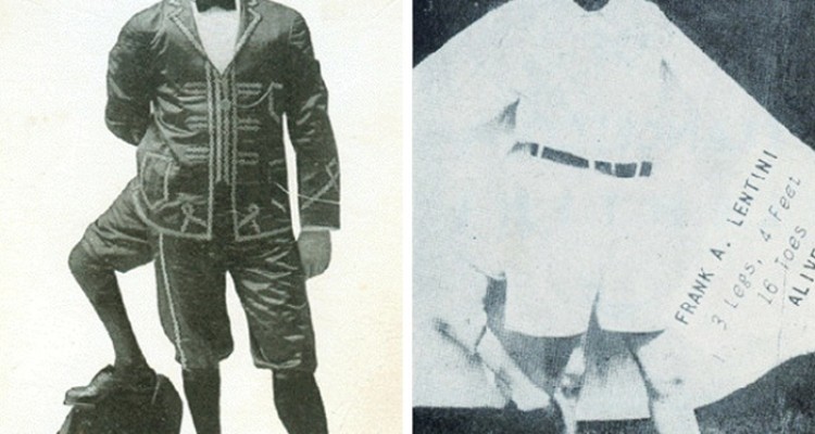  سرگذشت حقیقی ۹ انسان عجیب الخلقه که از شنیدنشان حیرت‌زده خواهید شد!+تصاویر