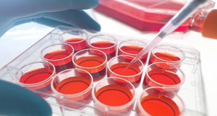 سلول‌های کوچکی که به جنگ بیماری خودایمن می‌روند/ موفقیت دانشمندان ایرانی در مسیر درمان سرطان خون 