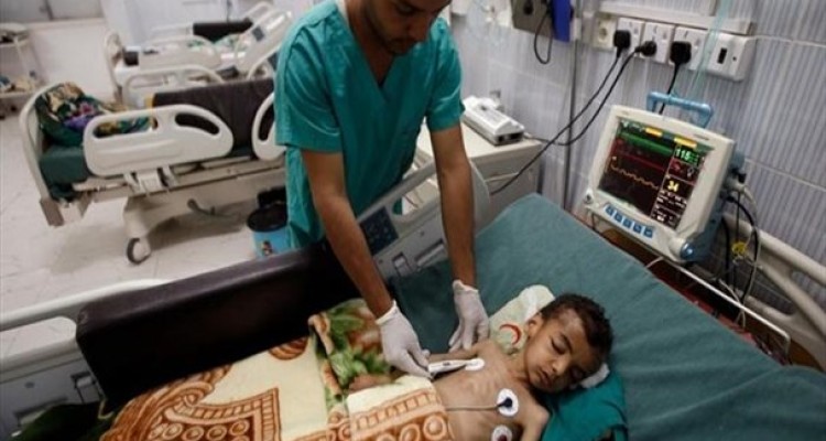 22 میلیون نفر در یمن به غذا دسترسی ندارند