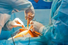 عمل جراحی موفقیت آمیز تعویض مفصل در بیمارستان اسلام آبادغرب