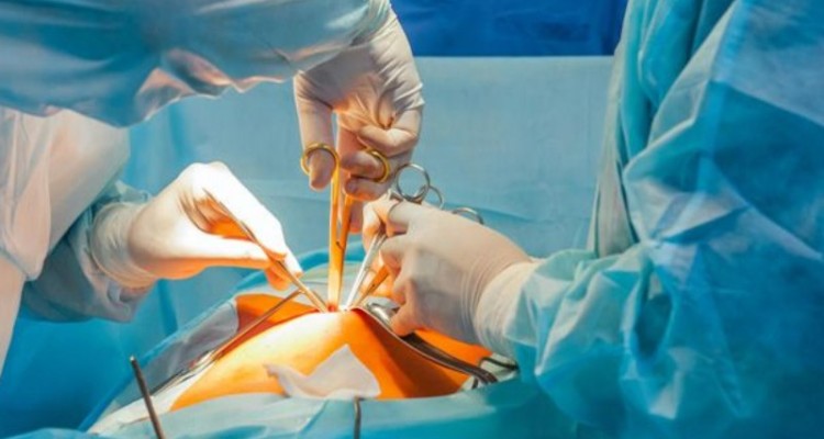 عمل جراحی موفقیت آمیز تعویض مفصل در بیمارستان اسلام آبادغرب