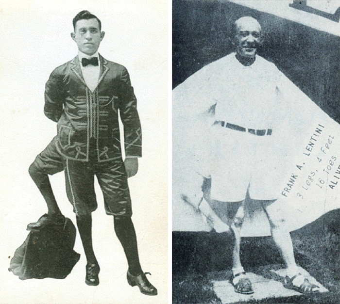  سرگذشت حقیقی ۹ انسان عجیب الخلقه که از شنیدنشان حیرت‌زده خواهید شد!+تصاویر