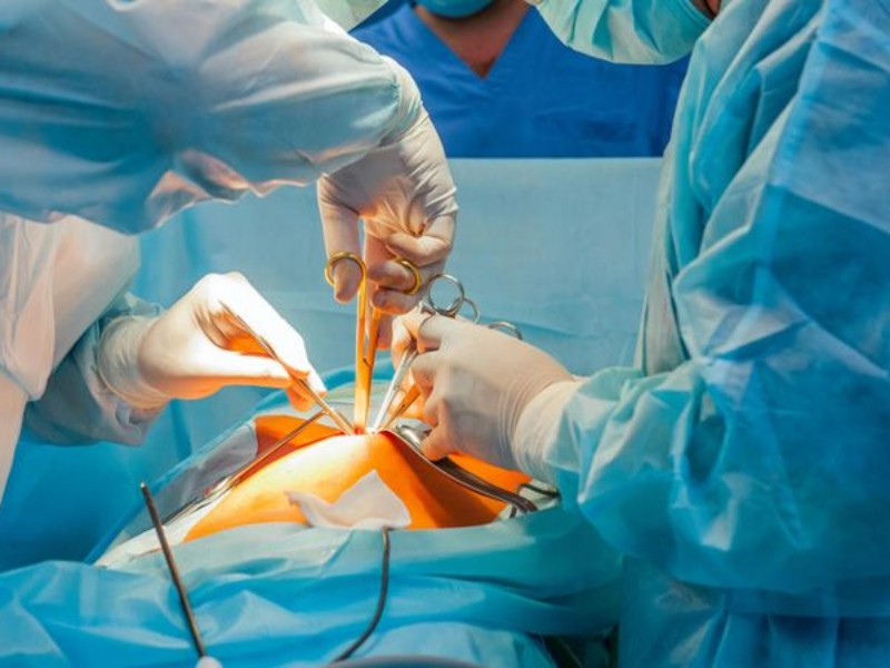 عمل جراحی موفقیت آمیز تعویض مفصل در بیمارستان اسلام آبادغرب